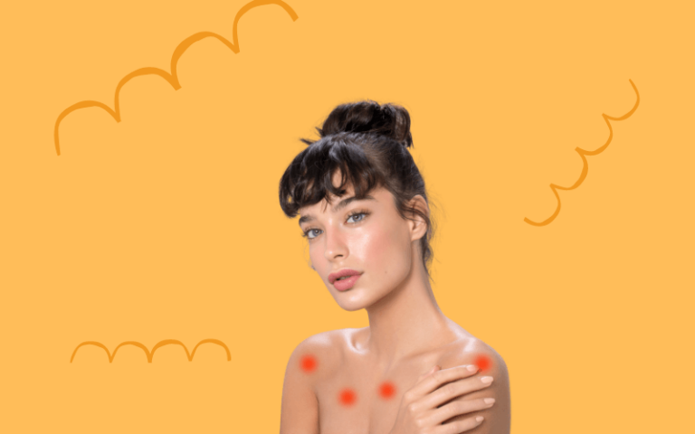 Simple Body Acne Hacks That’ll Make You Rethink Everything