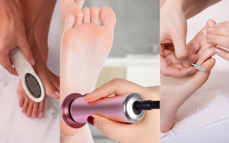 foot files, electric callus removers, and callus shavers