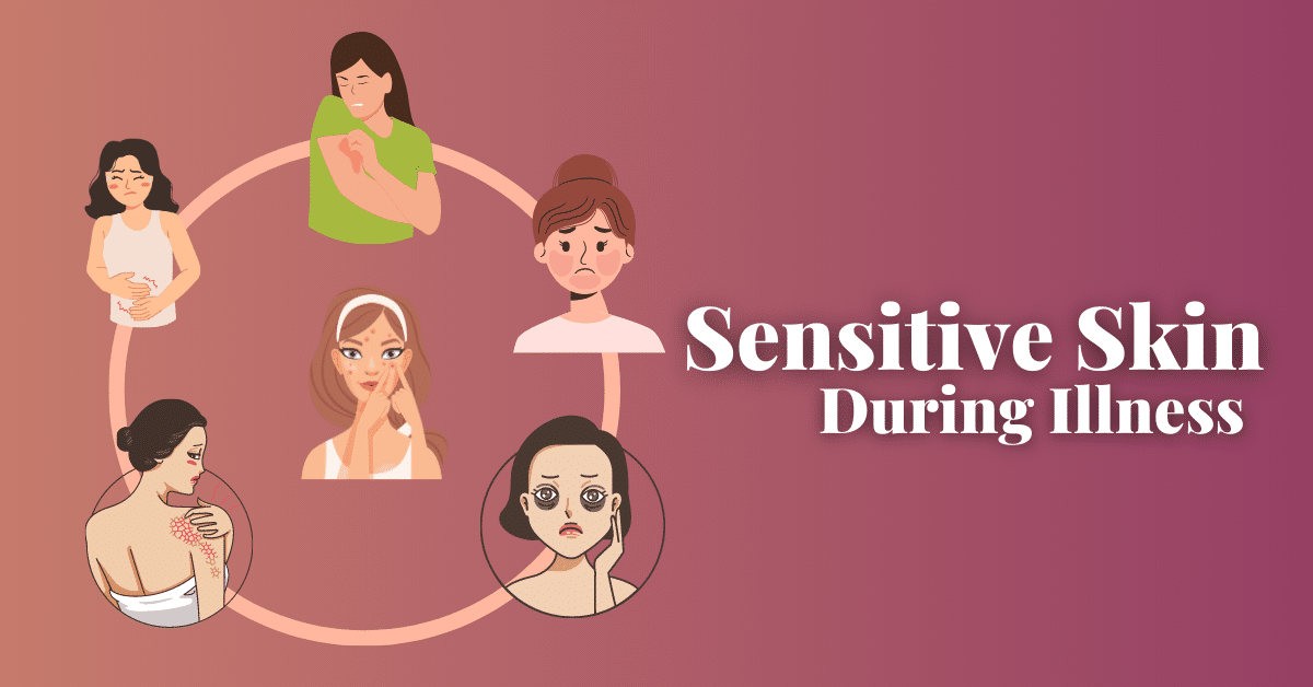 Sensitive Skin During Illness