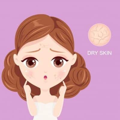 Dry Skin