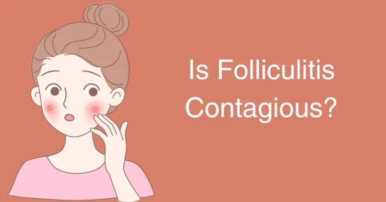Is Folliculitis Contagious? Understanding Acute Bacterial Skin Infections