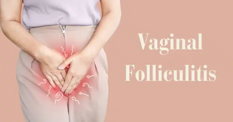 Vaginal Folliculitis: Understanding Causes, Symptoms, and Treatment