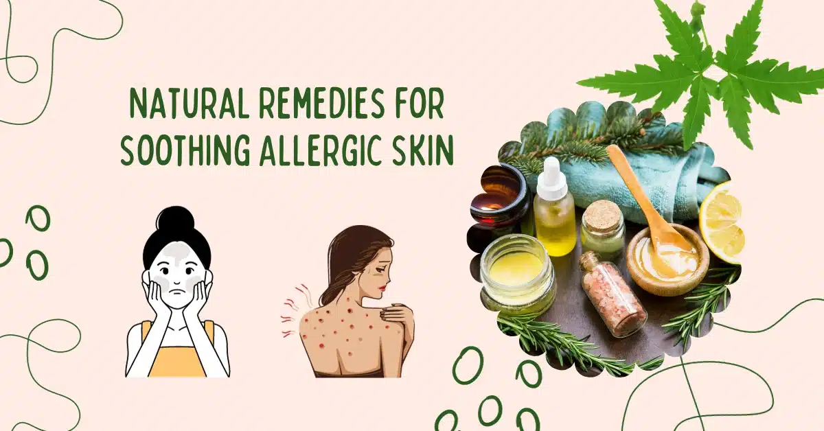 Natural Remedies For Soothing Allergic Skin